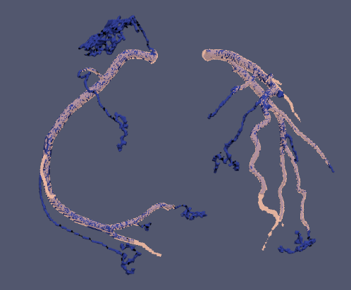 Model B output overlaid with nnU-Net prediction